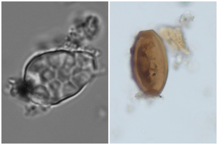 Rice starch granules and Trichuris egg